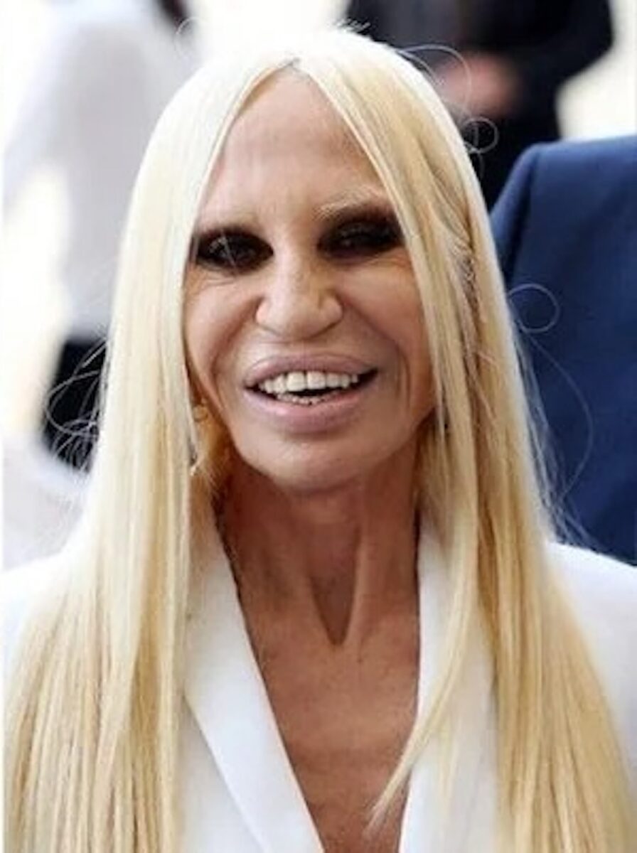 Donatella Versace dopo il ritocco