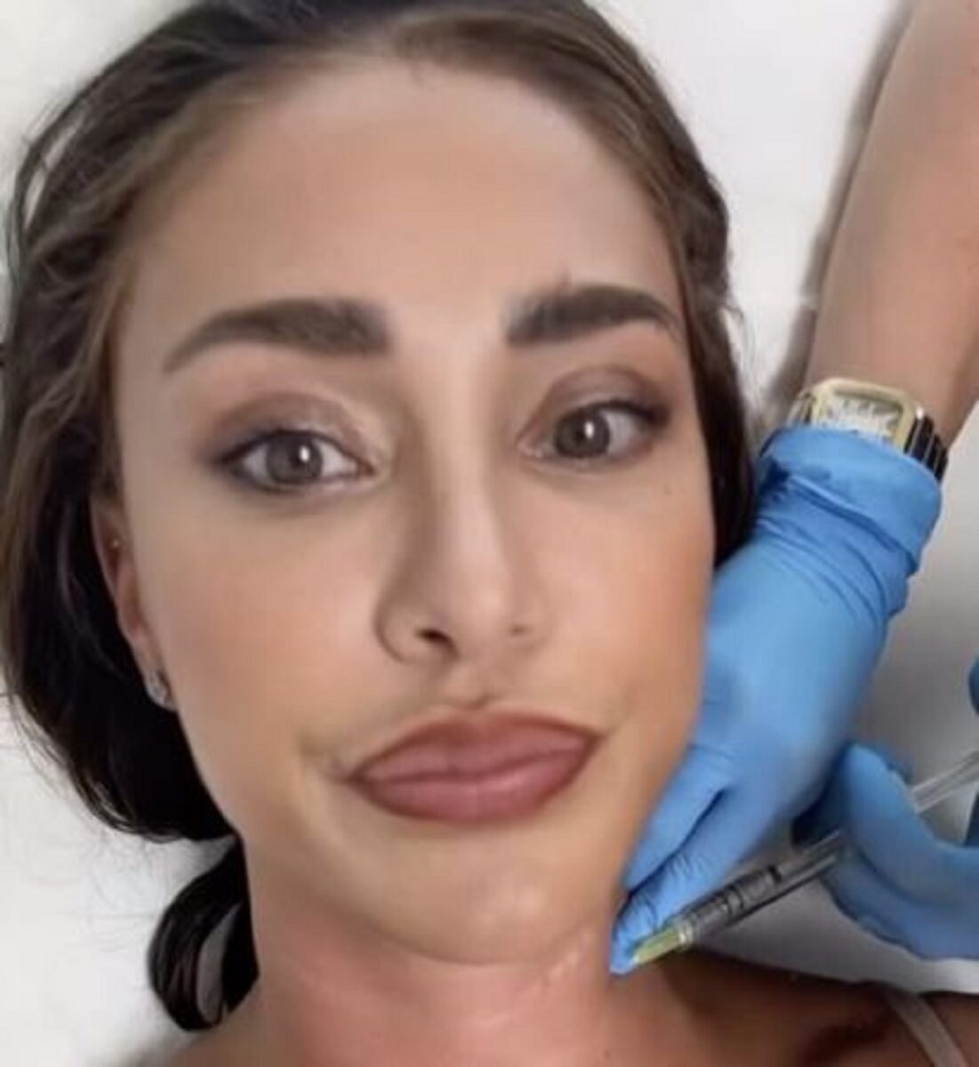 Effetti post-trattamento sul collo di Belen Rodriguez